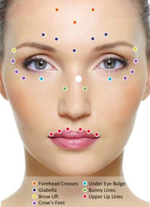 Botox Treatment London | Faciem Dermatology Clinic